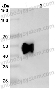 Anti-Human CD37/TSPAN26 Antibody (HH1)