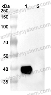 Anti-Human CD142/F3/TF Antibody (SAA0059)