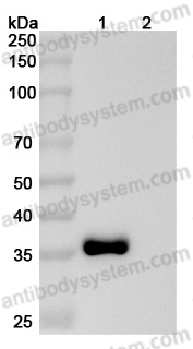 Anti-Human PRLR Antibody (SAA2060)