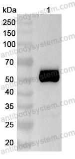 Anti-Human TSHR/LGR3 Antibody (M22)