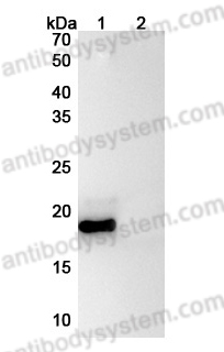 Anti-Human IL11 Antibody (SAA0379)