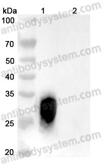 Anti-Human CD79β/CD79B Antibody (SAA0036)