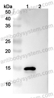 Anti-Human CCL7/MCP-3 Antibody (SAA0539)