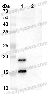 Anti-Human IL17A Antibody (SAA0387)