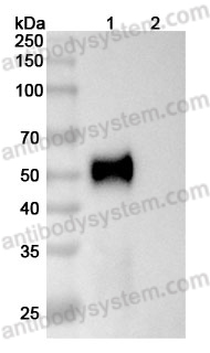 Anti-Human AMHR2/MISRII Antibody (12G4)