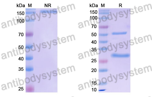 Human IgA2 Isotype Control Antibody (13R4)