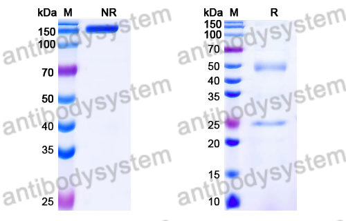 Human IgG2 Isotype Control Antibody (HyHEL-10)