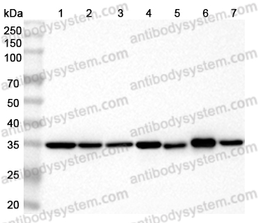 Anti-Human GAPDH Monoclonal Antibody (1A201)