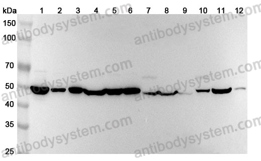 Anti-Human CD87/PLAUR/uPAR Monoclonal Antibody (1A451)