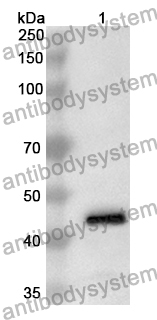 Anti-Bovine DNTT/TDT Polyclonal Antibody