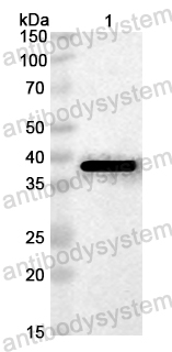 Anti-Cat Fel d 1B/CH2/Allergen FdI Polyclonal Antibody