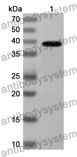 Anti-Human KIF2A Polyclonal Antibody