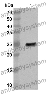 Anti-SNAP23 Polyclonal Antibody