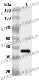 Anti-Human FXYD1 Polyclonal Antibody