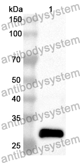 Anti-AIP Polyclonal Antibody