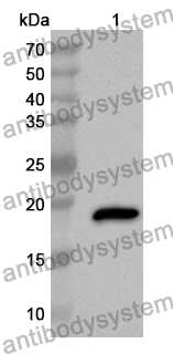 Anti-LGALS9 Polyclonal Antibody