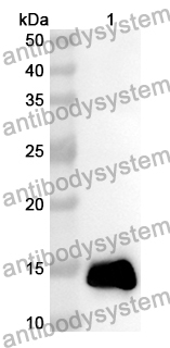 Anti-MASP2 Polyclonal Antibody