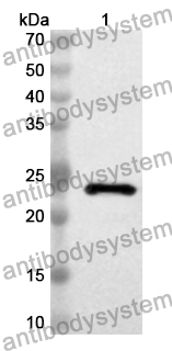 Anti-Human RAB27B Polyclonal Antibody