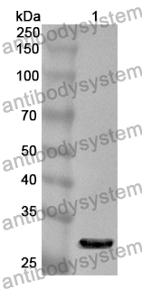 Anti-AP3B1 Polyclonal Antibody