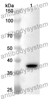 Anti-LGALS8 Polyclonal Antibody