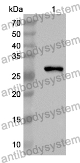 Anti-NFKBIE Polyclonal Antibody