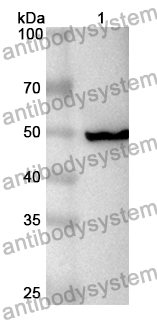 Anti-Human PSMD11 Polyclonal Antibody