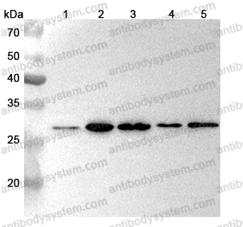 Anti-PSMD9 Polyclonal Antibody