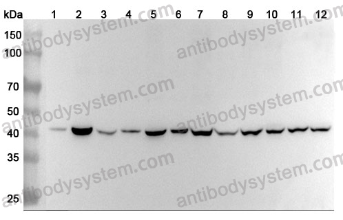 Anti-Human CD172b/SIRPB1 Polyclonal Antibody