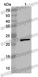 Anti-MEN1 Polyclonal Antibody