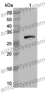 Anti-DFFA Polyclonal Antibody