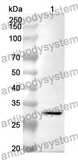 Anti-TNFRSF11B Polyclonal Antibody