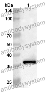 Anti-Human SULT1C2 Polyclonal Antibody