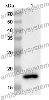 Anti-QSOX1 Polyclonal Antibody