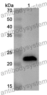 Anti-Human DCTN6 Polyclonal Antibody