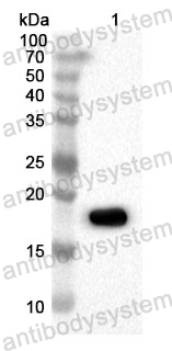 Anti-Human WASL Polyclonal Antibody