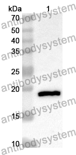 Anti-Human PDE2A Polyclonal Antibody