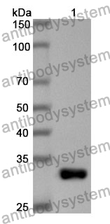 Anti-Human EEF2K Polyclonal Antibody