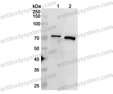 Anti-IGF2BP3 Polyclonal Antibody