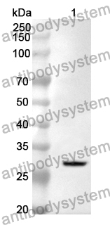 Anti-PIK3C2A Polyclonal Antibody