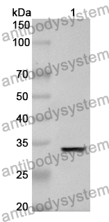 Anti-PLK4 Polyclonal Antibody