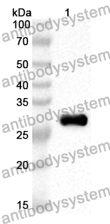 Anti-Human PLOD2 Polyclonal Antibody