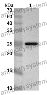 Anti-MEIS1 Polyclonal Antibody