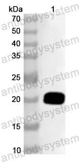Anti-Human EXOC5 Polyclonal Antibody