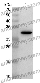 Anti-NR5A2 Polyclonal Antibody