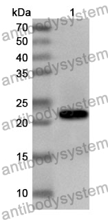 Anti-Human PSMD14 Polyclonal Antibody