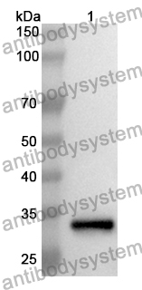 Anti-BIN1 Polyclonal Antibody