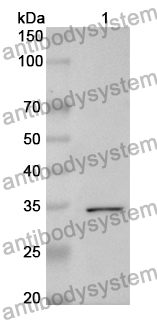 Anti-SDCBP Polyclonal Antibody