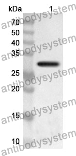 Anti-Human DDX3X Polyclonal Antibody