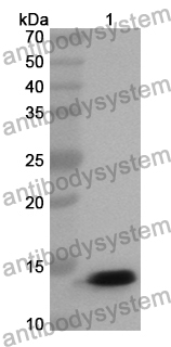 Anti-Human CCL21/6Ckine Polyclonal Antibody