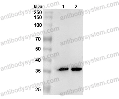 Anti-FCN1 Polyclonal Antibody